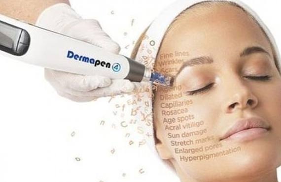 dermapen