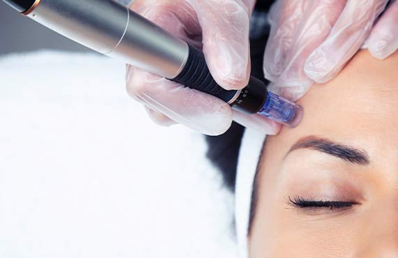 mesotherapy